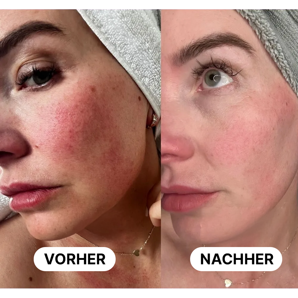 Dermalicht® Maske